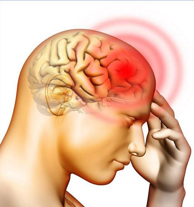 क्या आपको भी होता है ये भयानक सर दर्द..