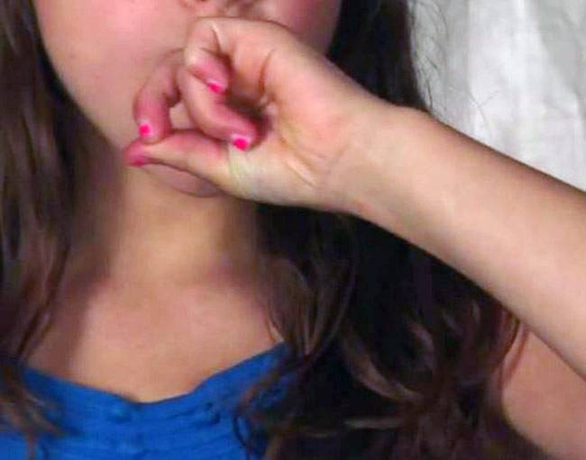 हिचकी आने पर आपको क्या करना चाहिए...