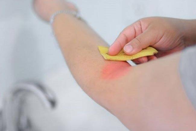 केले के छिलके के 10 हैरान कर देने वाले फायदे...