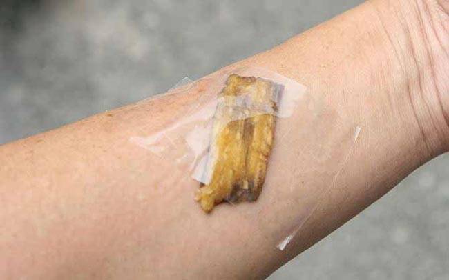 केले के छिलके के 10 हैरान कर देने वाले फायदे...