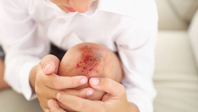 घरेलू उपचार अपनाने से पहले एक बार ये भी जानें...