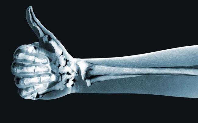 वजन घटाने के लिए खाएं किशमिश, जानें क्यों...