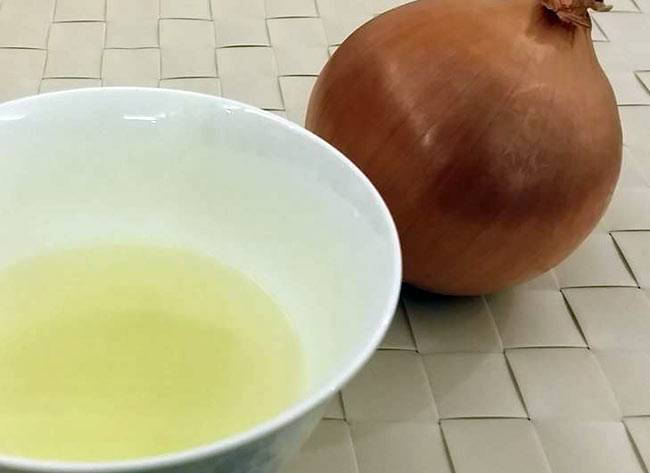 सफेद बाल की परेशानी क्या छीन रही है आपकी जवानी...