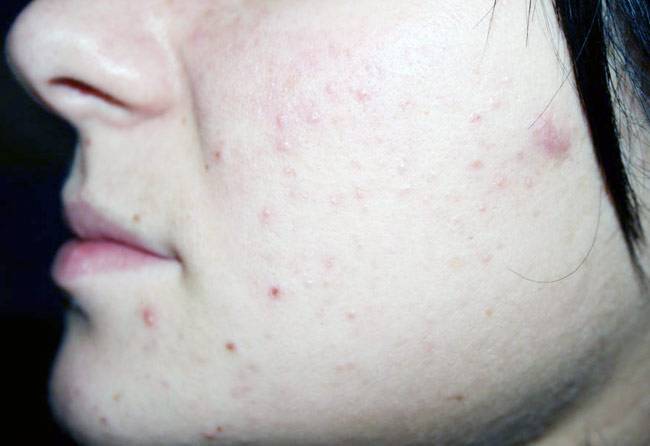 खूबसूरती में दीपिका-सोनम को पीछे छोड़ना हो तो अखरोट आजमाओ...