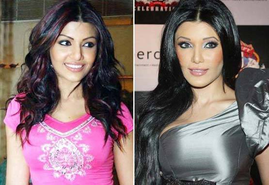 ये हैं बॉलीवुड के 10 चेहरे, जिनकी सर्जरी रही है फेल