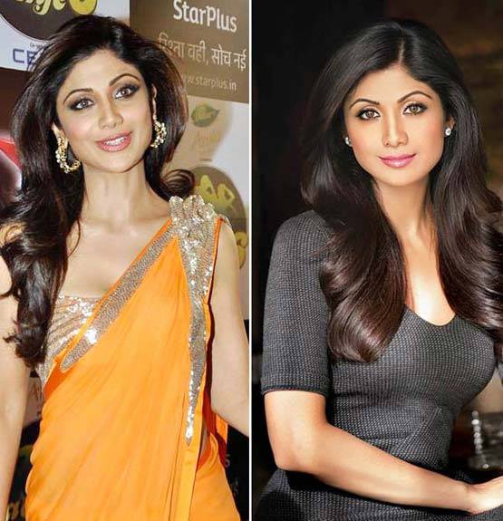 ये हैं बॉलीवुड के 10 चेहरे, जिनकी सर्जरी रही है फेल