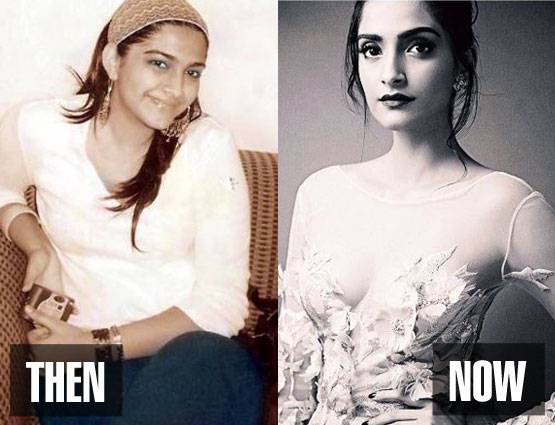 इन बॉलीवुड स्टार्स के पहले और बाद के लुक देखकर दंग रह जाएंगे आप