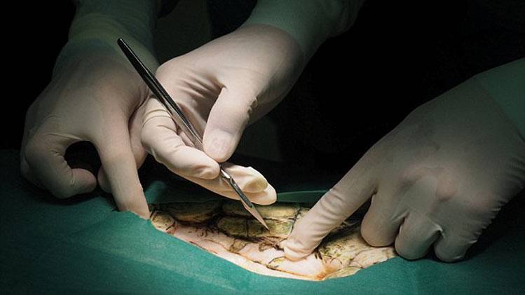 कछुए के पेट में एक-दो नहीं, 915 सिक्के, सर्जरी कर निकाले गए