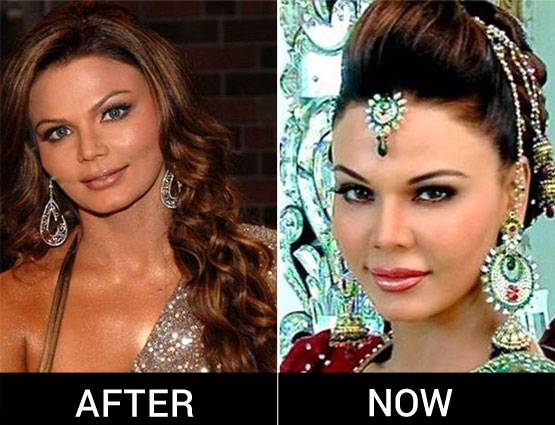 PHOTOS: आइटम गर्ल से ड्रामा क्वीन बनीं राखी का ऐसे बदला लुक