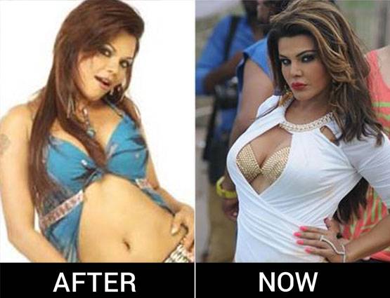 PHOTOS: आइटम गर्ल से ड्रामा क्वीन बनीं राखी का ऐसे बदला लुक