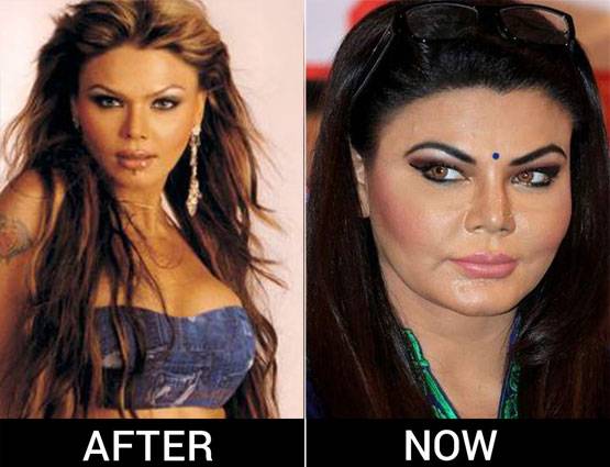 PHOTOS: आइटम गर्ल से ड्रामा क्वीन बनीं राखी का ऐसे बदला लुक