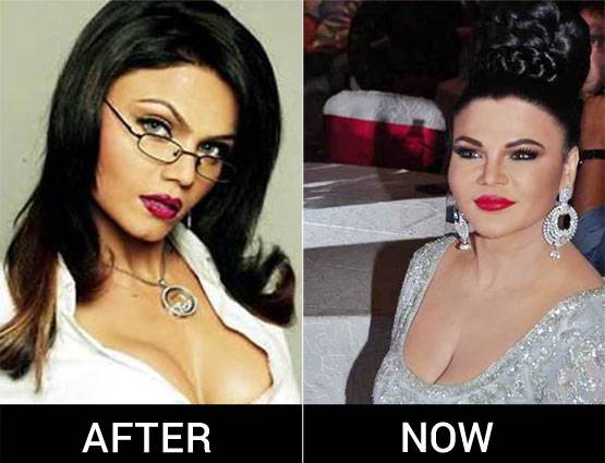 PHOTOS: आइटम गर्ल से ड्रामा क्वीन बनीं राखी का ऐसे बदला लुक