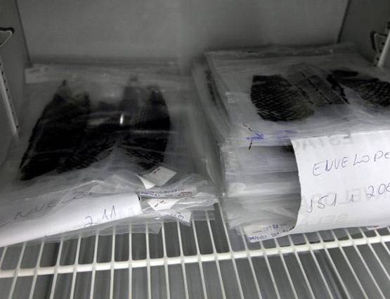 जले लोगों के ऊपर लगाते हैं मछली की स्किन, इस तरह डॉक्टर कर रहे इलाज