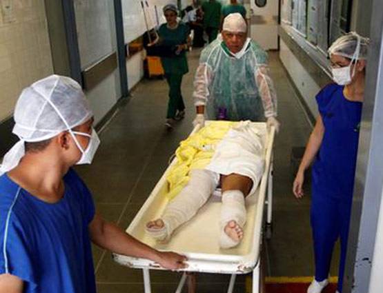 जले लोगों के ऊपर लगाते हैं मछली की स्किन, इस तरह डॉक्टर कर रहे इलाज