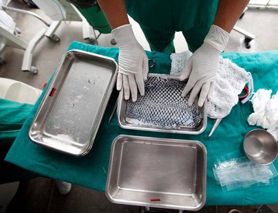 जले लोगों के ऊपर लगाते हैं मछली की स्किन, इस तरह डॉक्टर कर रहे इलाज