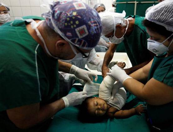 जले लोगों के ऊपर लगाते हैं मछली की स्किन, इस तरह डॉक्टर कर रहे इलाज