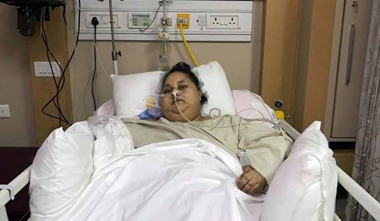 सबसे मोटी महिला ने घटाया 315 KG वजन, अब दिखती है ऐसी