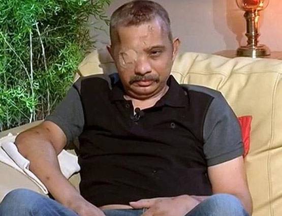 9 गोलियों से आंख, ब्रेन हो गई थी डैमेज, जवान ने ऐसे दी मौत को मात