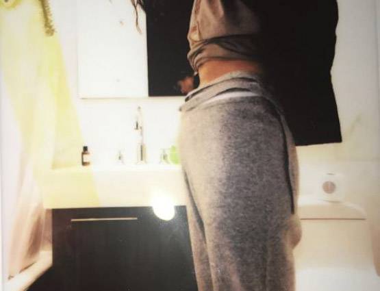 बेस्ट फ्रेंड ने किडनी देकर बचाई इस पॉप स्टार की जान