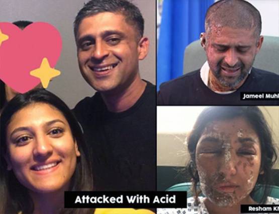 एसिड अटैक में बिगड़ चुकी थी सूरत, रिकवरी के बाद की फोटो वायरल
