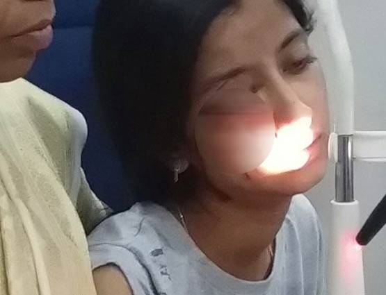 गर्ल्स हॉस्टल की बालकनी में खड़ी थी लड़की, आंख में आकर घुसा रॉकेट