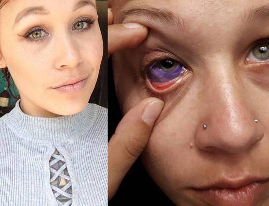 दिल्ली के टैटूग्राफर ने आंख में बनवाया टैटू, कहा- हमेशा से ये करवाना चाहता था