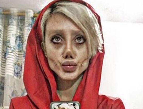 एंजेलिना जोली जैसा दिखना चाहती थी 19 साल की ये लड़की, बन गई कार्टून