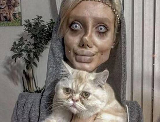 एंजेलिना जोली जैसा दिखना चाहती थी 19 साल की ये लड़की, बन गई कार्टून