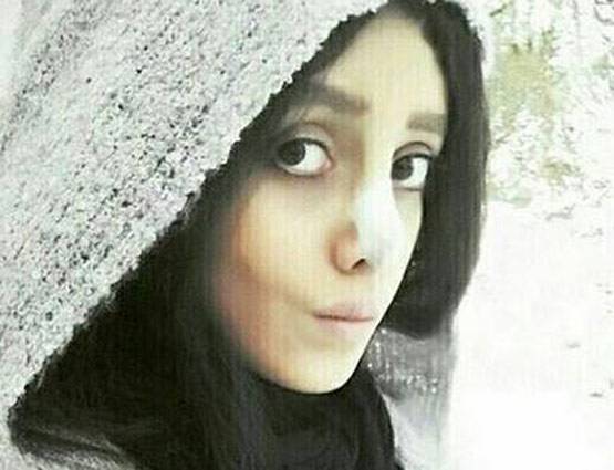 एंजेलिना जोली जैसा दिखना चाहती थी 19 साल की ये लड़की, बन गई कार्टून