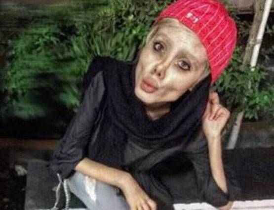 एंजेलिना जोली जैसा दिखना चाहती थी 19 साल की ये लड़की, बन गई कार्टून