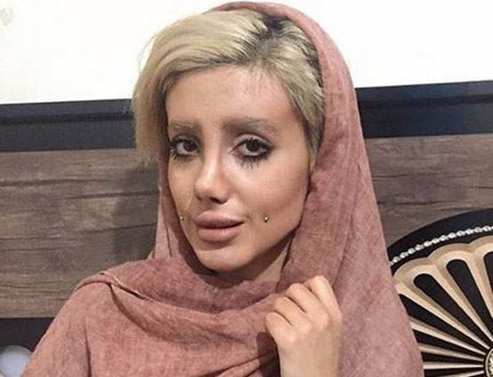 एंजेलिना जोली जैसा दिखना चाहती थी 19 साल की ये लड़की, बन गई कार्टून