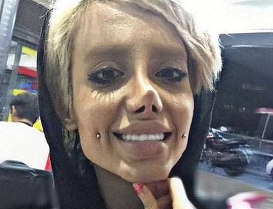 एंजेलिना जोली जैसा दिखना चाहती थी 19 साल की ये लड़की, बन गई कार्टून