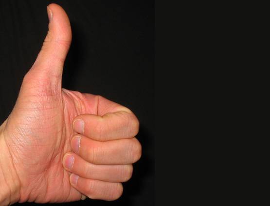 क्या आपका भी अंगूठा ऐसे मुड़ जाता है, जानिए मतलब
