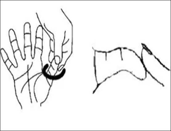 क्या आपका भी अंगूठा ऐसे मुड़ जाता है, जानिए मतलब