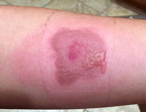 दुनिया के खतरनाक गेम्स, खिलाड़ी करता है सुसाइड या लेता है जान