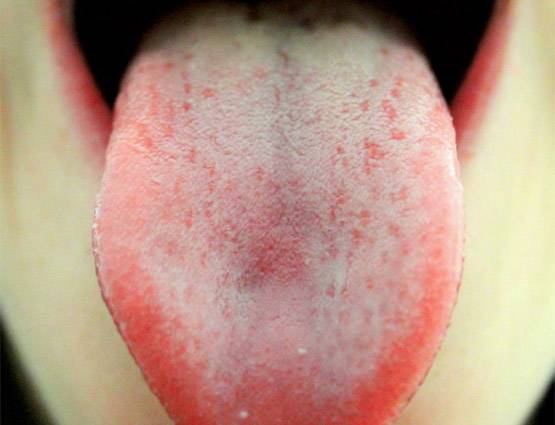 मुंह की दुर्गंध दूर करने के बेहद आसान उपाय