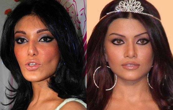 सर्जरी से खराब हुआ चेहरा, ऐसे बिगड़ा इस एक्ट्रेस का करियर