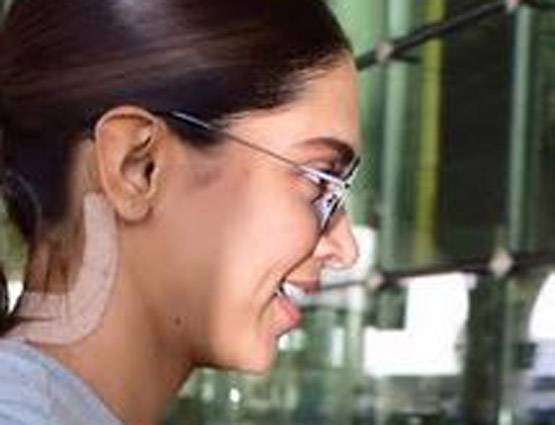 गर्दन पर बैंडेज, क्या दीपिका हटवा रही हैं रणबीर के नाम का टैटू?