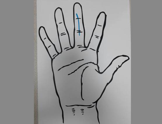 दुआ करिए कि आपकी हथेली पर ना हो ऐसे निशान!