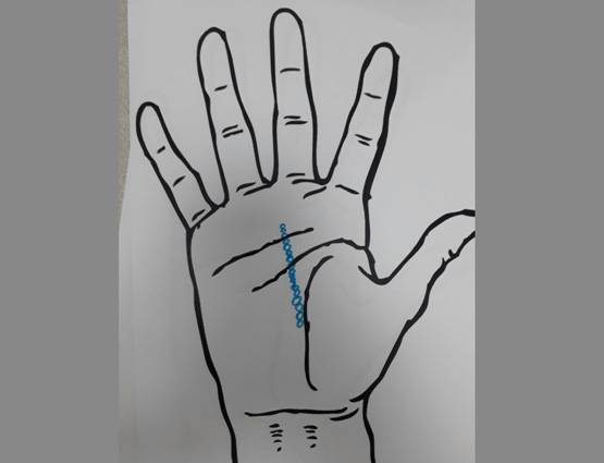 दुआ करिए कि आपकी हथेली पर ना हो ऐसे निशान!