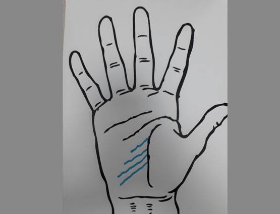 दुआ करिए कि आपकी हथेली पर ना हो ऐसे निशान!