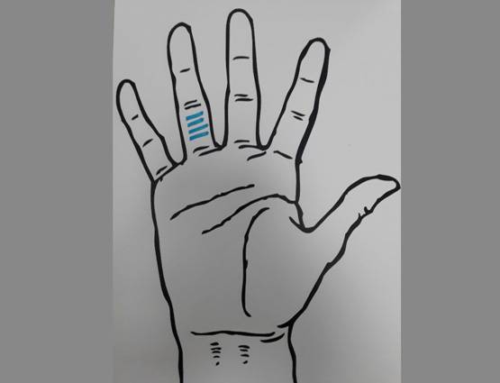 दुआ करिए कि आपकी हथेली पर ना हो ऐसे निशान!