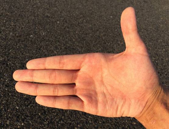 दुआ करिए कि आपकी हथेली पर ना हो ऐसे निशान!