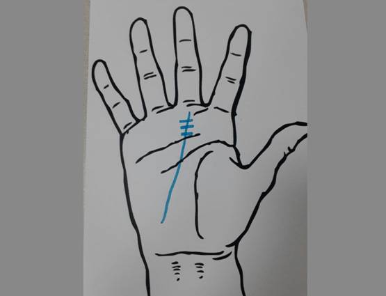 दुआ करिए कि आपकी हथेली पर ना हो ऐसे निशान!