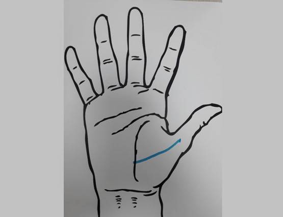 दुआ करिए कि आपकी हथेली पर ना हो ऐसे निशान!