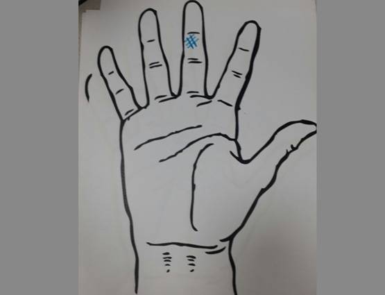 दुआ करिए कि आपकी हथेली पर ना हो ऐसे निशान!