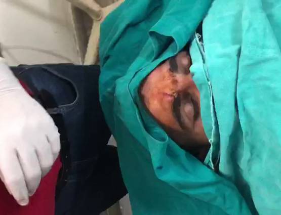 पत्नी से परेशान थे शमी, एक्सीडेंट में हुए जख्मी, देखें- PICS