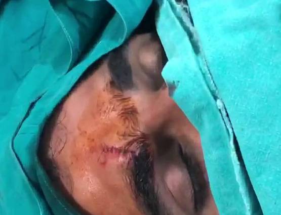 पत्नी से परेशान थे शमी, एक्सीडेंट में हुए जख्मी, देखें- PICS