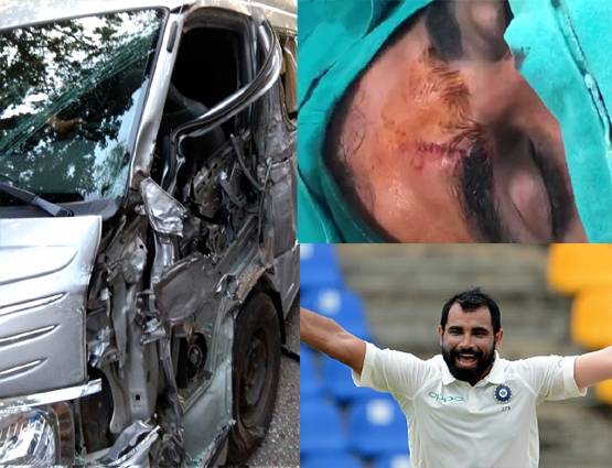पत्नी से परेशान थे शमी, एक्सीडेंट में हुए जख्मी, देखें- PICS