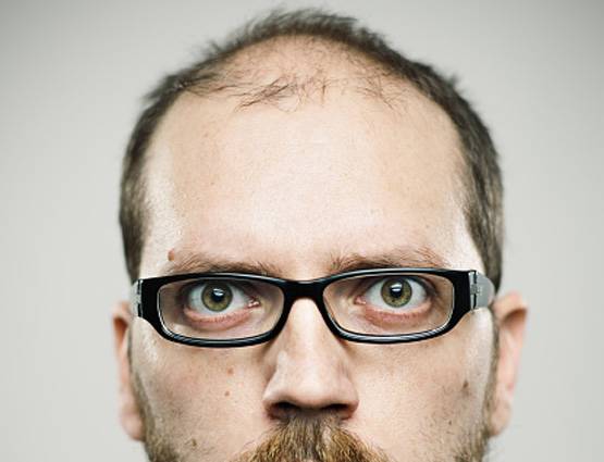 किसी दवा की जरूरत नहीं, बालों को झड़ने और सफेद होने से ऐसे रोकें